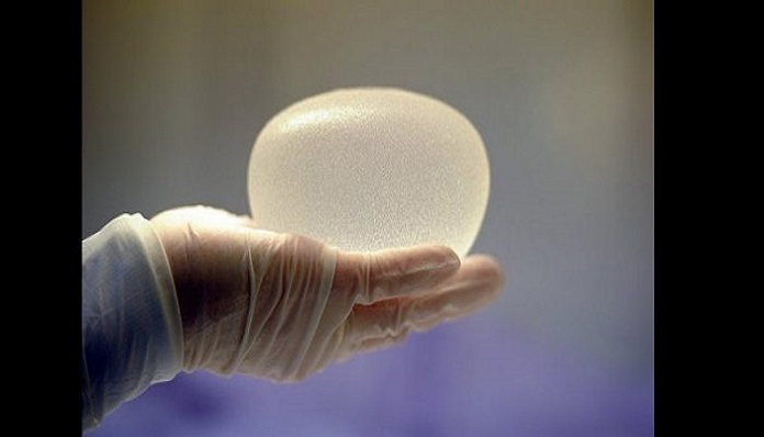 implants-702x336