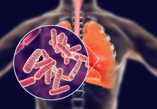 1,5 million de personnes meurent de tuberculose en 2018 – OMS